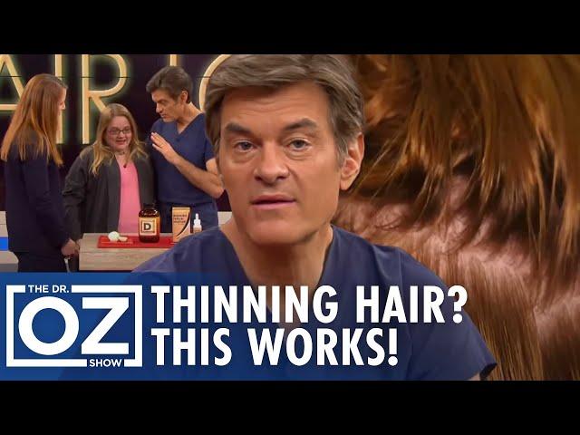How to Reverse Hair Loss Naturally? Dr. Oz’s Hair Regrowth Plan Revealed | Oz Beauty & Skincare