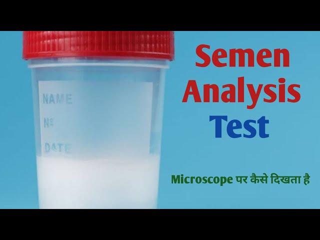 Semen test procedure I  sperm count