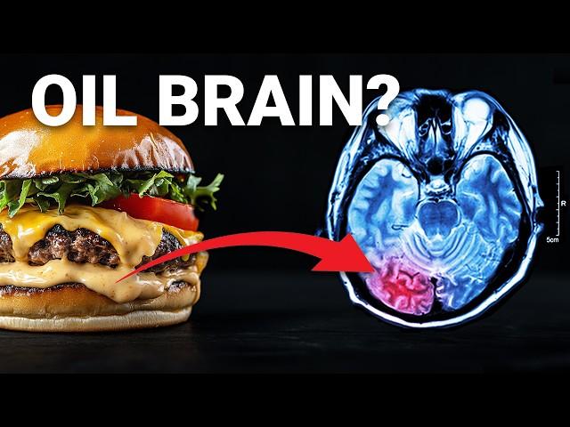 The $212 Billion Dollar Food ingredient poisoning your Brain