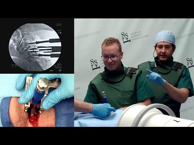 Artificial Disc Replacement - Rod J. Oskouian, Jr, MD