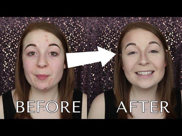 ACNE COVERAGE FOUNDATION ROUTINE | CHRISTINA ELIZABETH