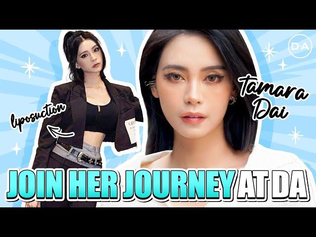 [DA Plastic Surgery] Tamara's Transformation Journey at DA!  #koreaplasticsurgerybeforeafter