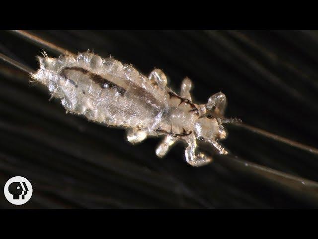 How Lice Turn Your Hair Into Their Jungle Gym | Deep Look