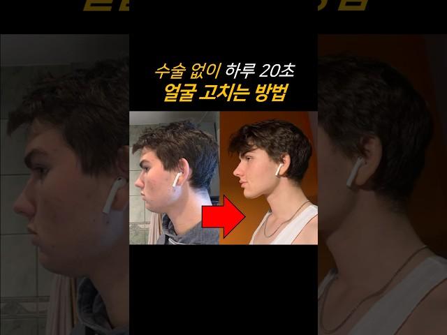 돌출입 개선? 뮤잉 운동 소름 돋는 효과… #shorts
