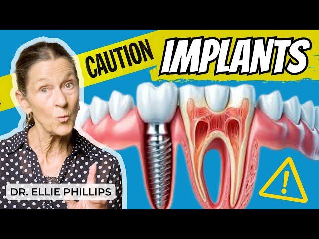 The Risk of Dental Implants