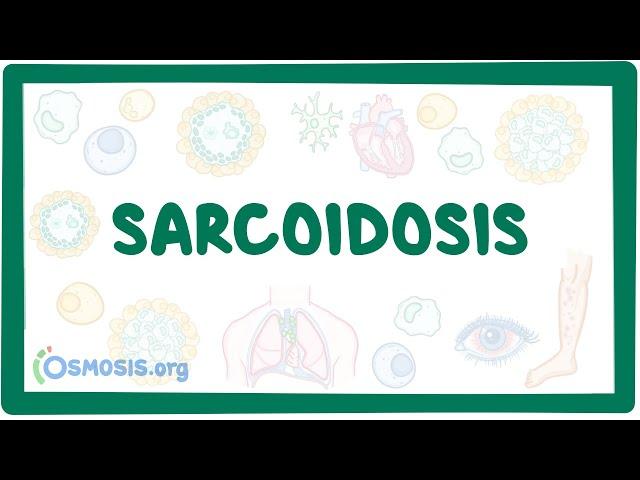 Sarcoidosis - causes, symptoms, diagnosis, treatment, pathology