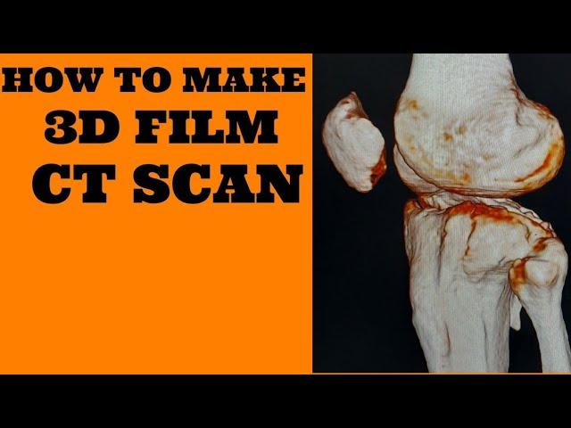 CT SCAN 3D FILM