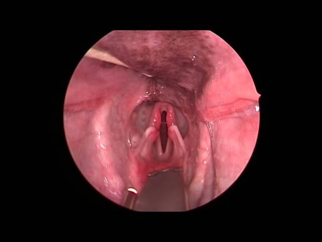 Dog: Lar Par (Laryngeal paralysis observed in sedated canine oral exam)