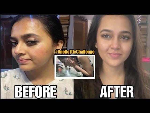 Acne & Oil Control With The #OneBottleChallenge | Does it work??