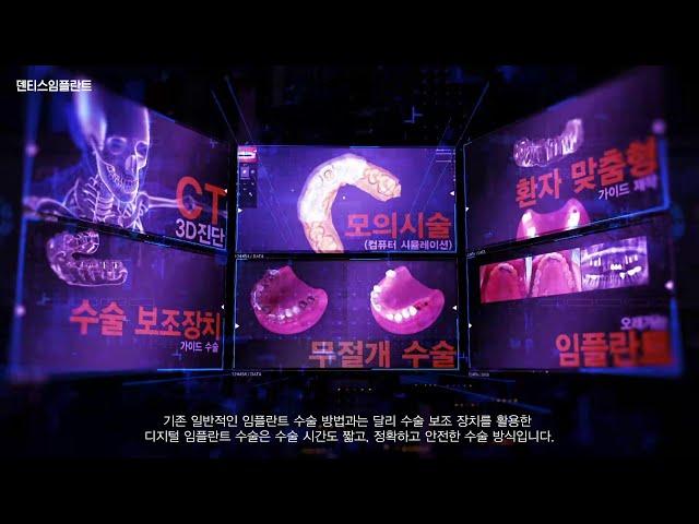 치과 대기실에서 알아보는 디지털 임플란트! ｜ 덴티스임플란트