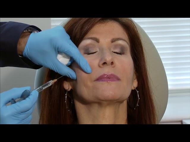 Dr. Jason Bloom's Cheek Challege for Mid-Face or Cheek Lifting and Filling
