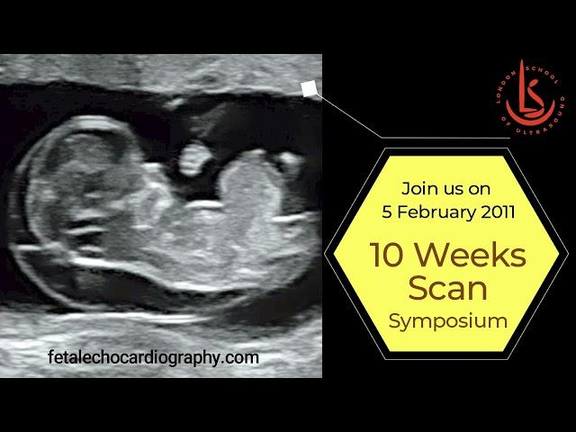 10 Weeks Scan Symposium 2022