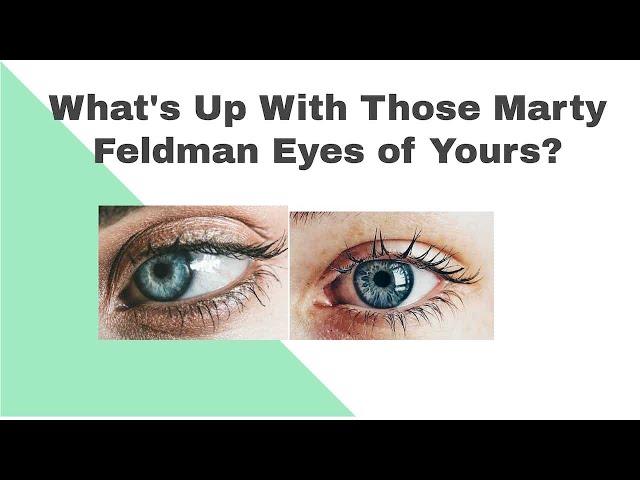 Marty Feldman Eyes ... explained.