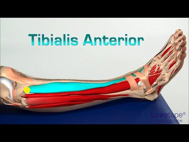 Levotape Kinesiology Tape - how to treat shin splints