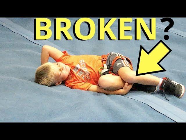 BROKEN LEG ROCK CLIMBING!?!?! 