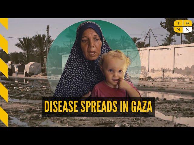 'Look at my granddaughter': Israel weaponizes disease in Gaza