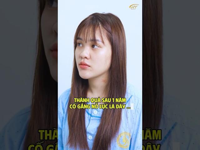 Thành quả xứng đáng sau 1 năm nỗ lực của cô bạn T. Mẩy 2k1 đến từ Lào Cai #drhoangtuan #nangmui