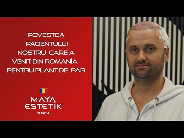 Povestea  Pacientului  Nostru  Care a Venit Din Romania  Pentru İmplant de Par