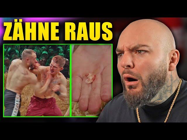 Zähne raus GEPRÜGELT! Kranker Kampf bei TopDog! RINGLIFE