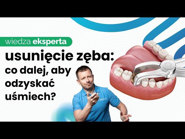 IMPLANTACJA NATYCHMIASTOWA BEZBOLESNE USUWANIE ZĘBÓW I WSZCZEPIENIE IMPLANTU PO EKSTRAKCJI