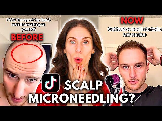 Can You Grow Back Hair With Scalp Microneedling? Does Scalp Microneedling Work?