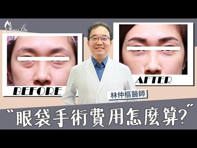 【美貌知尋識EP.16眼袋費用如何計算？】整外醫師執刀，永久告別眼袋困擾！#眼袋手術 #台北整形外科