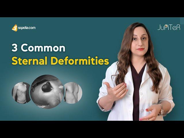 Sternum | Bone Anatomy | 3 Common Sternal Deformities | Skeletal System | V-Learning™