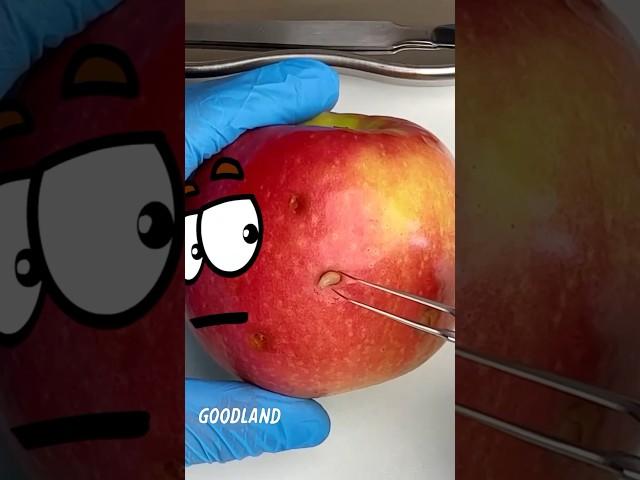 Goodland | Apple surgery #goodland #shorts #doodles #doodlesart