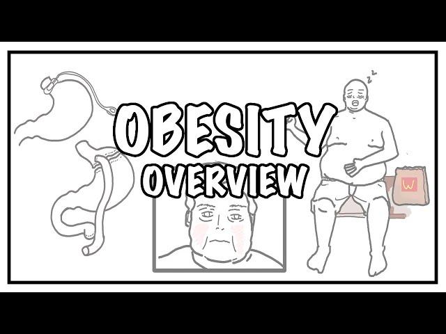 Approach to OBESITY and Weight gain - causes, risk factors, BMI, complications and treatment