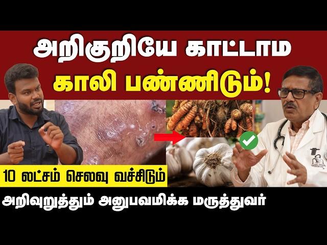 Fatty Liver : கல்லீரல் பற்றி யாருக்கும் தெரியாத அதிர்ச்சி தகவல்ககள் | Liver | Positivitea