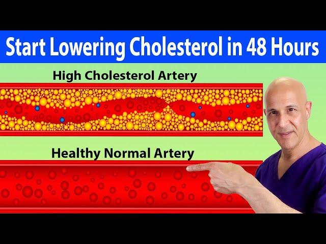 Start Lowering Your Cholesterol Naturally Within 48 Hours!  Dr. Mandell