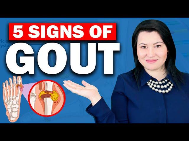 Gout: Everything You Need to Know