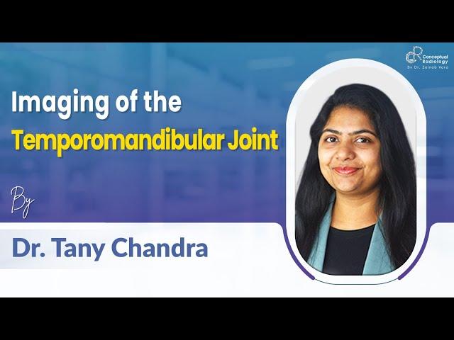 Imaging of the Temporomandibular Joint by Dr. Tany Chandra #radiologyresidency