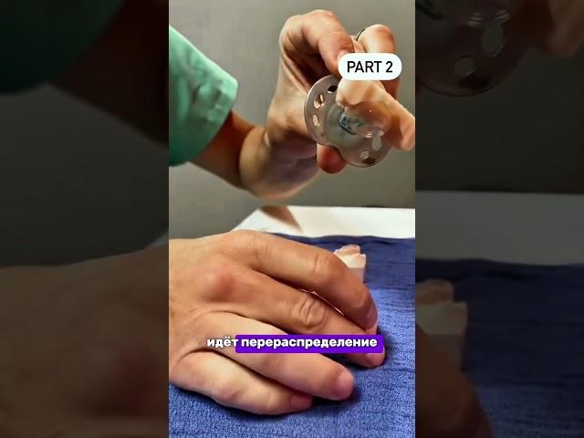 КАК ПРАВИЛЬНО ПОДОБРАТЬ СОСКУ ДЛЯ РЕБЕНКА | СОВЕТЫ СТОМАТОЛОГА