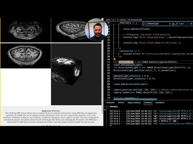 Enhancing 3D Brain MRI Visualization: Implementing Real-Time Rendering with Optimized Techniques