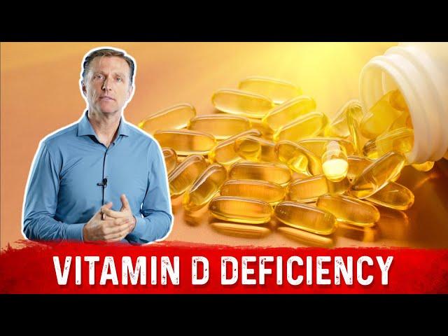 Reasons for Deficiency of Vitamin D – Dr.Berg