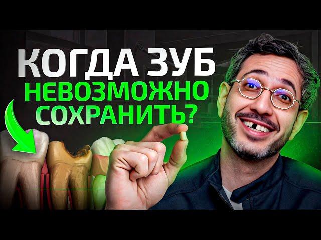 Какие должны быть показания для удаления зуба? УДАЛЕНИЕ ЗУБОВ