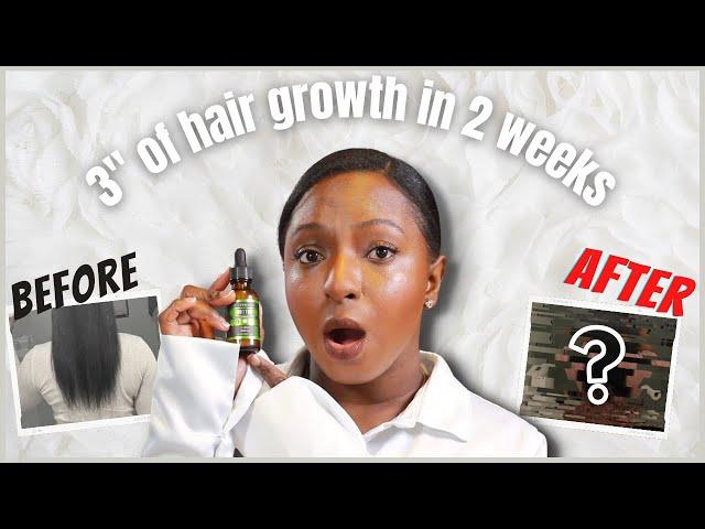 10,000 mcg Biotin for massive hair growth | BEFORE & AFTER | 3+ INCHES under a MONTH