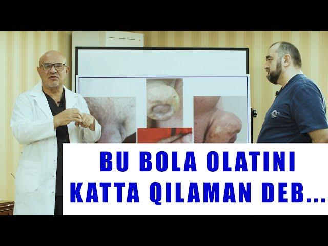 BU BOLA OLATINI KATTA QILAMAN DEB...