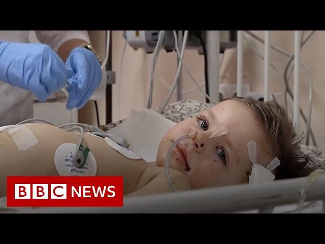 The child victims of Russia’s war in Ukraine - BBC News