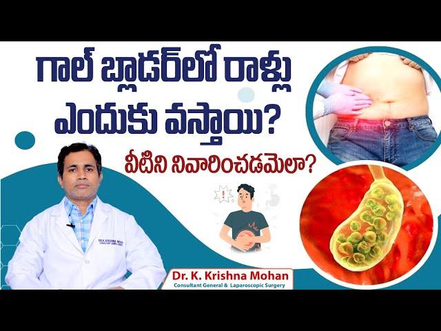 గాల్ బ్లాడర్ లో రాళ్లు || Symptoms and Treatment of Gallbladder Stones in Telugu || Renova Hospitals