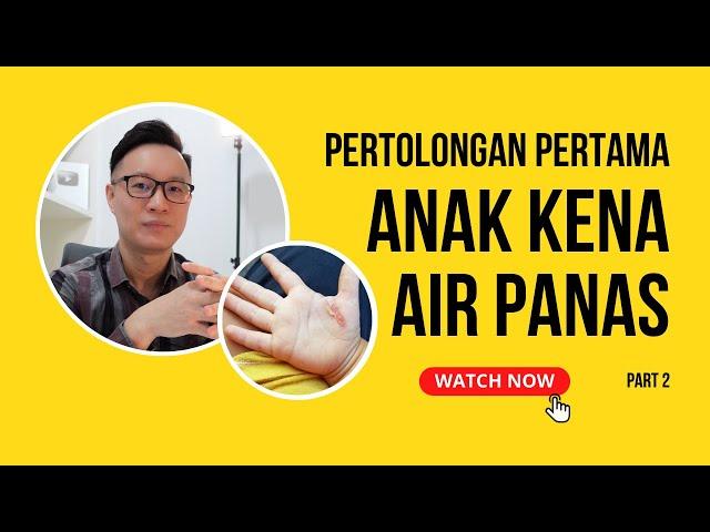 PERTOLONGAN PERTAMA ANAK TERSIRAM AIR PANAS | PART 2