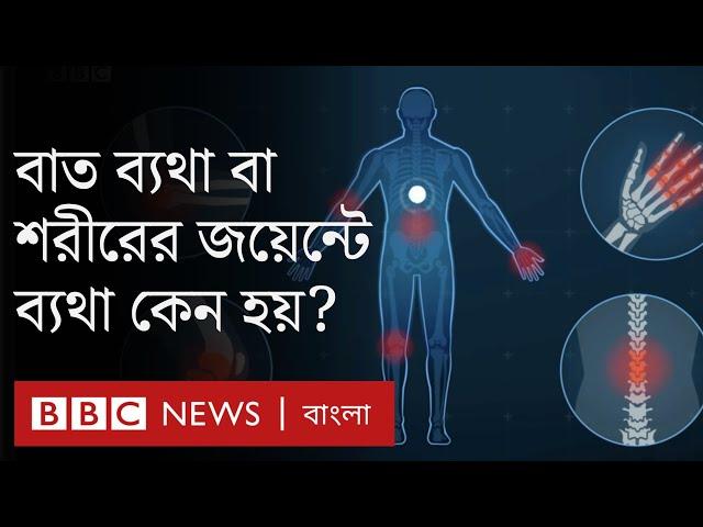 Arthritis: হাঁটু বা শরীরের জয়েন্টে ব্যথা বা বাত ব্যথা কেন হয়? লক্ষণ কী? এরকম ব্যথা কমানোর উপায় কী?