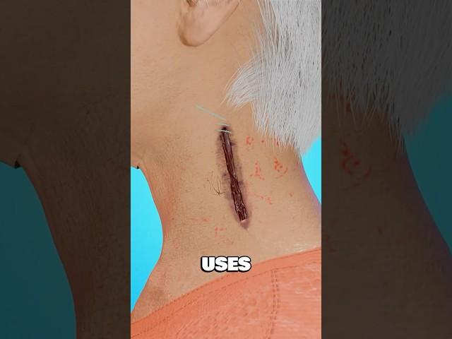 You Don’t Know How Stitches Actually Work…