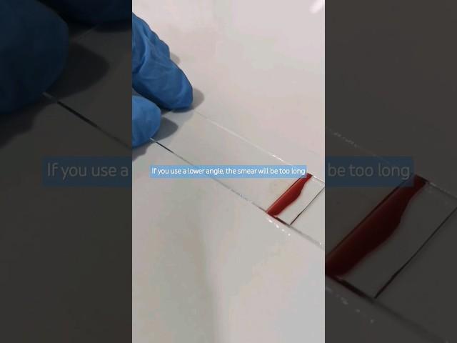 All about Blood Smear PART 1 #hematology #bloodsmear #laboratory #mls #cls #medtechstudent #medtech