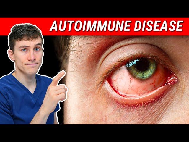 The SHOCKING Truth about Autoimmune Disease and Eye Health