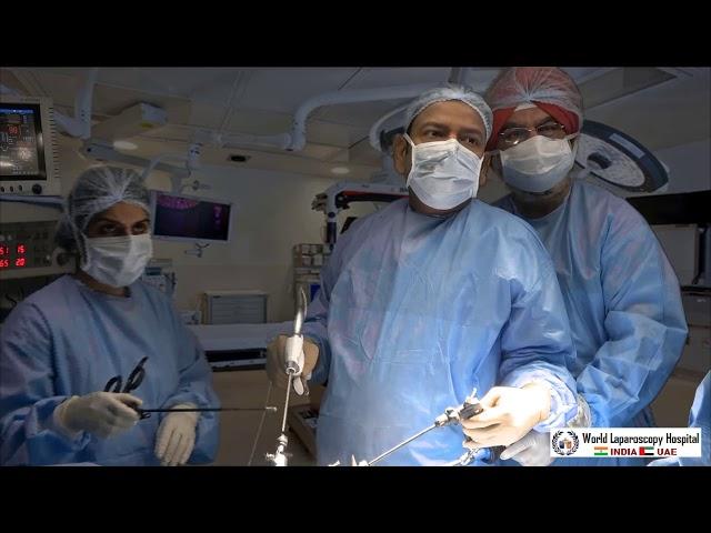 Laparoscopic Cholecystectomy Full Length Skin to Skin Video with Near Infrared Cholangiography