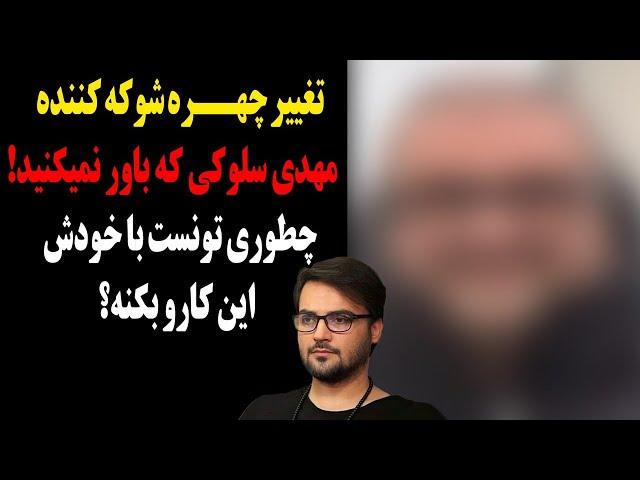 تغییر چهره شوکه کننده مهدی سلوکی که باور نمیکنید!چطوری تونست با خودش این کارو بکنه؟