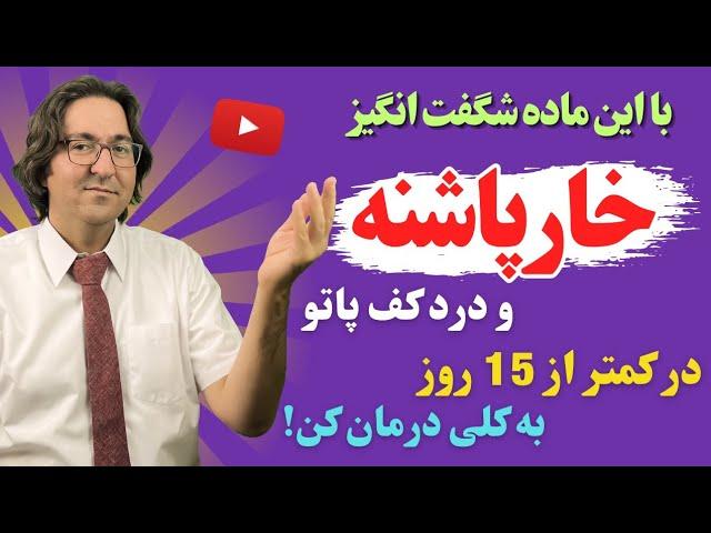 درمان طلایی و مجرب خار پاشنه و درد کف پا در کمتر از 15 روز به روش دکتر جاوید