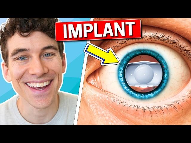 I got EVO ICL Eye Surgery - Here's What Happened